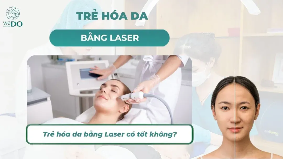 Trẻ hóa da bằng laser có tốt không? Ưu nhược điểm cần biết