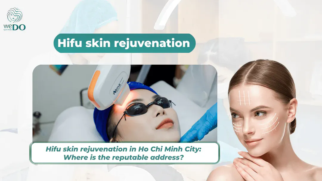 Hifu skin rejuvenation in Ho Chi Minh City: Where is the reputable address?