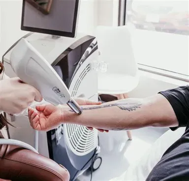 Q-SWITCHED ND YAG Laser Technology