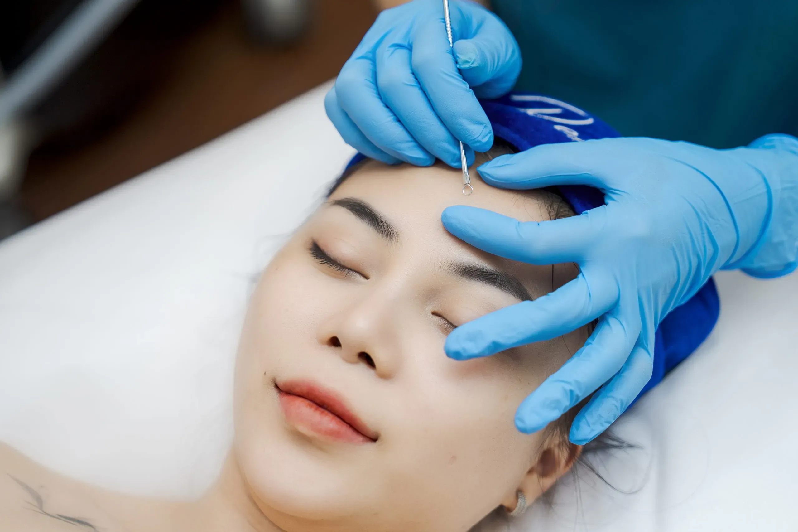 BASIC ACNE FACIAL CARE