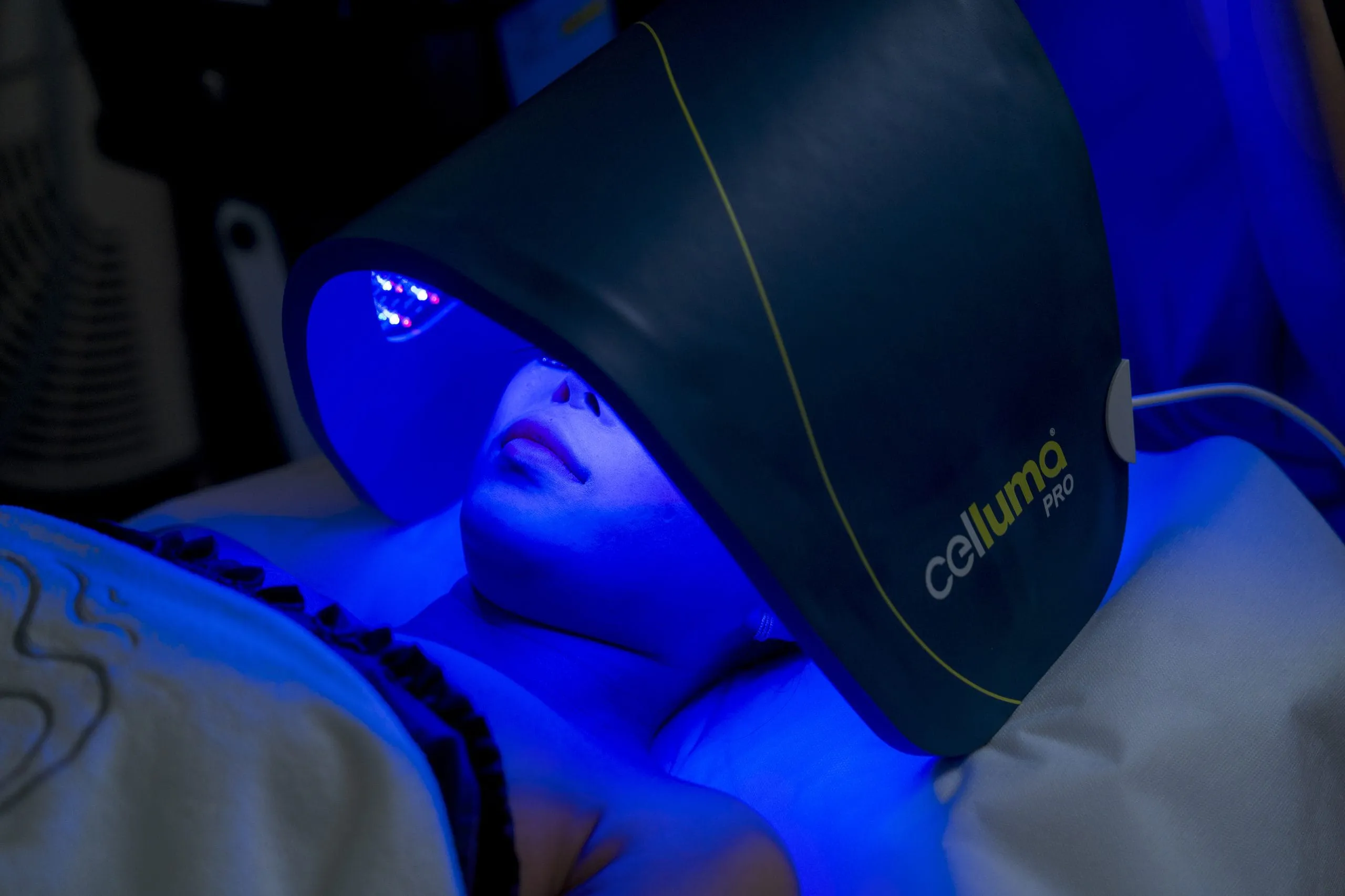CHĂM SÓC DA MỤN - Phương pháp CELLUMA Light