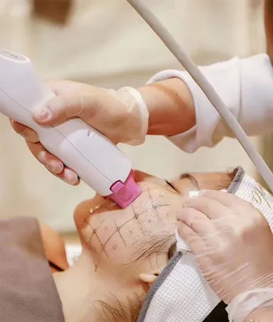 Công nghệ trẻ hoá da Thermage