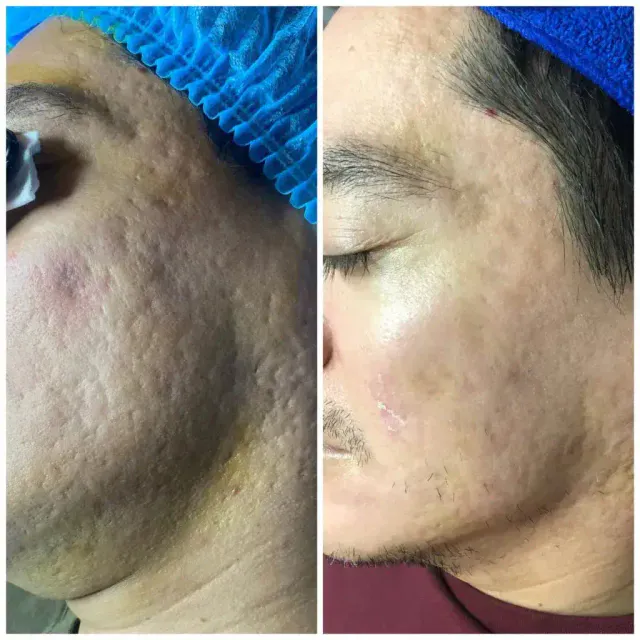 Skin Recovery Journey with Mr. Daniel