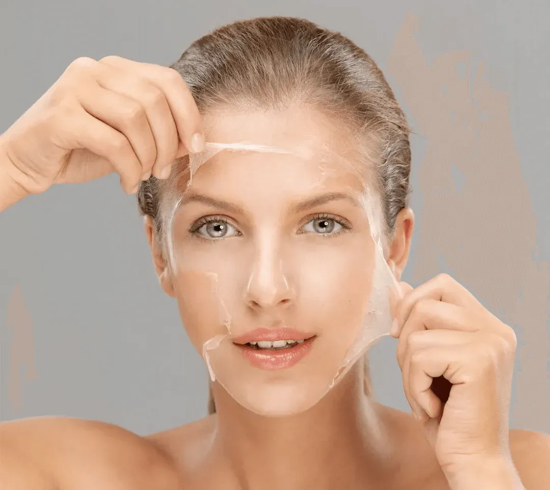 Chemical peel