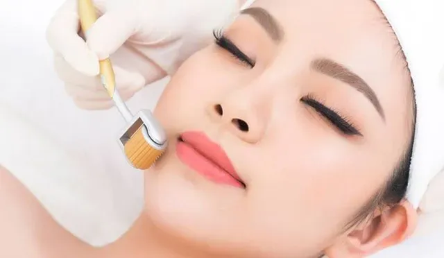 Lăn kim / Phi kim / RF Needling