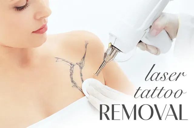 LASER TATTOO REMOVAL (Q-SWITCH ND: YAG)