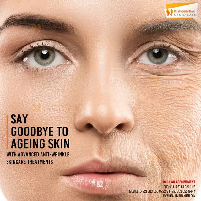 Who is Thermage For?