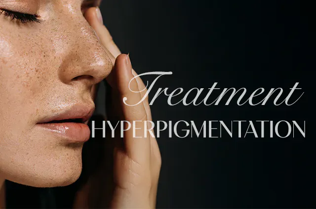 MELASMA TREATMENT – FRECKLES & DARK SPOTS REMOVAL