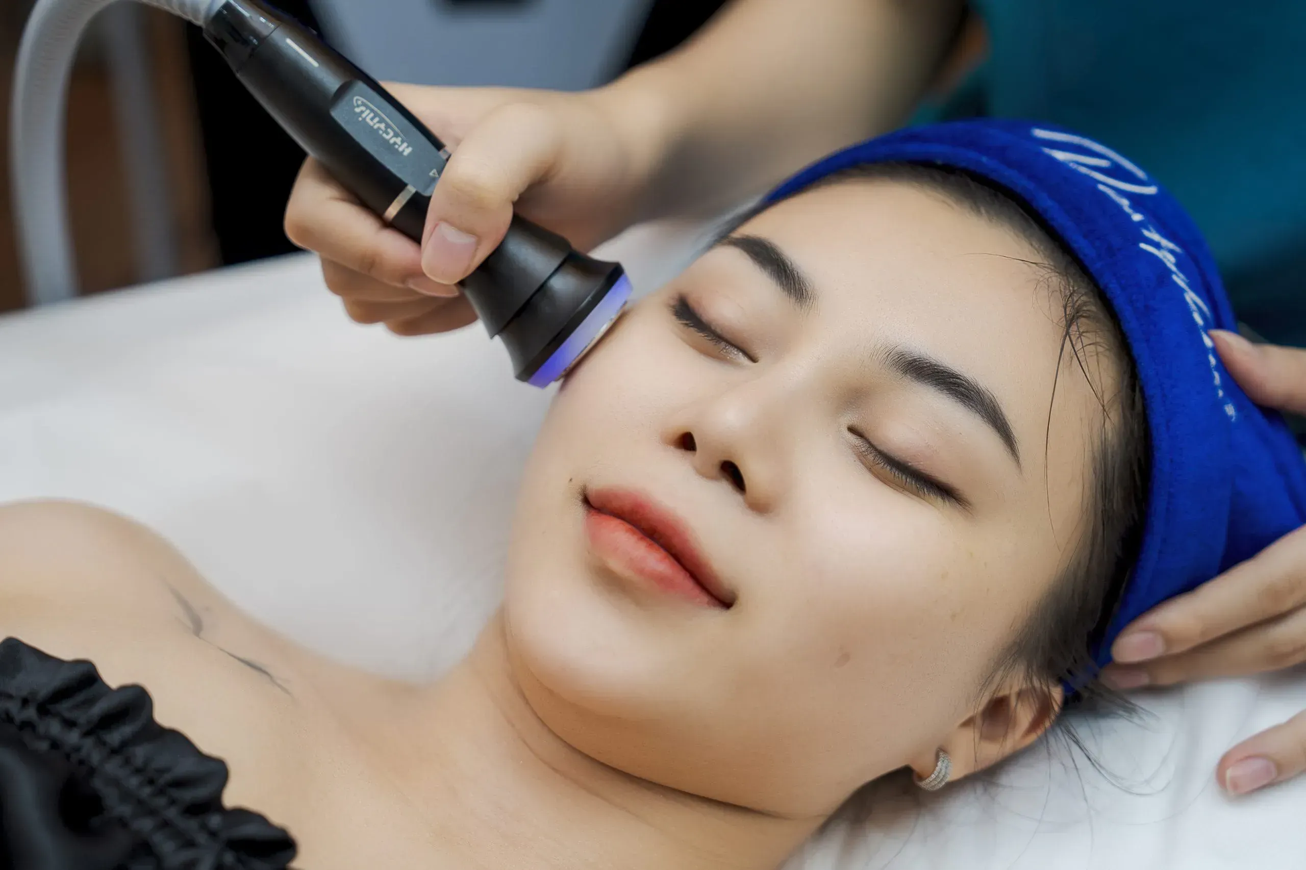 Laser Acne Treatment Clinic in Ho Chi Minh City: Procedure, Cost & Important Notes