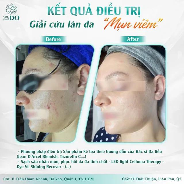 Clear and firm skin to welcome the Vietnamese New Year