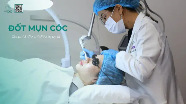 Chi phí loại bỏ mụn cóc ở TP.HCM: Địa điểm uy tín và giá hợp lý