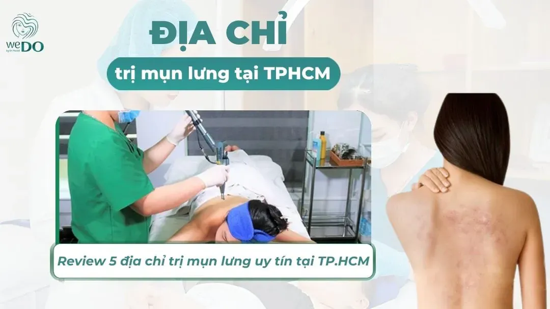 Review 5 địa chỉ trị mụn lưng uy tín hàng đầu tại TP.HCM