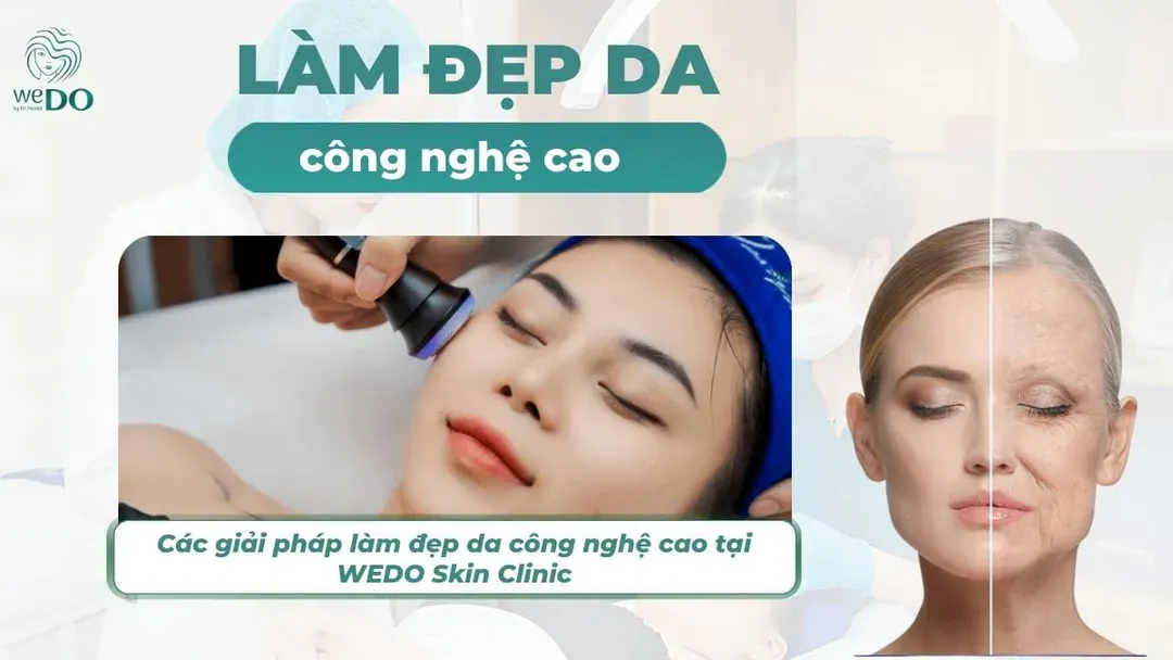 Các giải pháp làm đẹp da công nghệ cao tại WEDO Skin Clinic