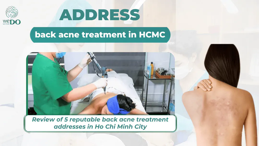 Review of the top 5 reputable back acne treatment addresses in Ho Chi Minh City