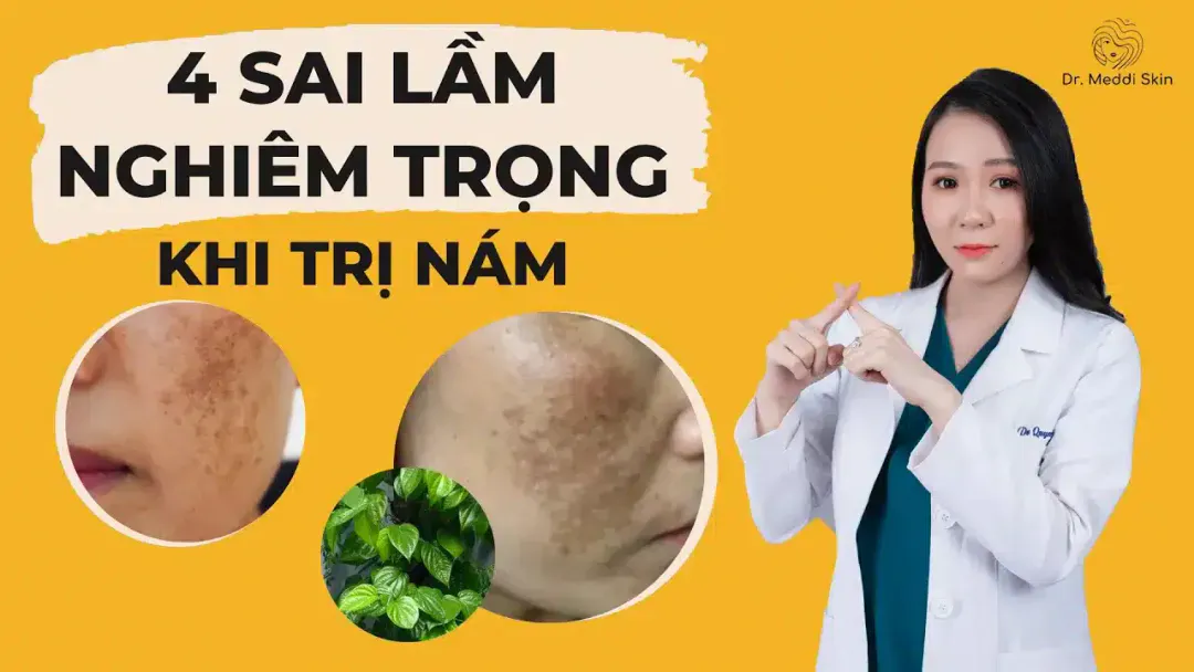4 Serious Mistakes When Treating Melasma/Skin Whitening That Cause Irreparable Damage