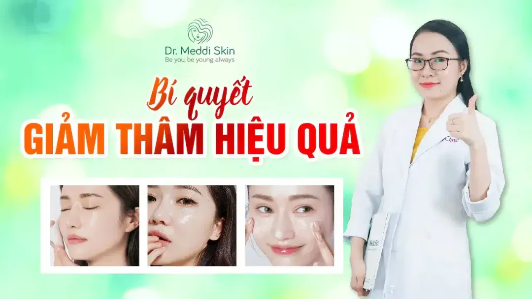 BỊ THÂM KHÔNG ĐƯỢC BỎ LỠ !!! Bí quyết GIẢM THÂM HIỆU QUẢ