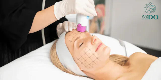 Công nghệ Thermage có tốt không? Có nên chọn Thermage để trẻ hóa da không?