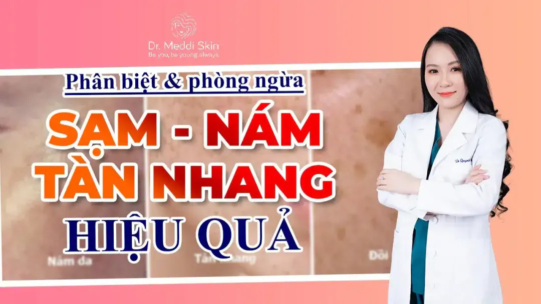 Tàn nhang khác nám và đồi mồi như thế nào?