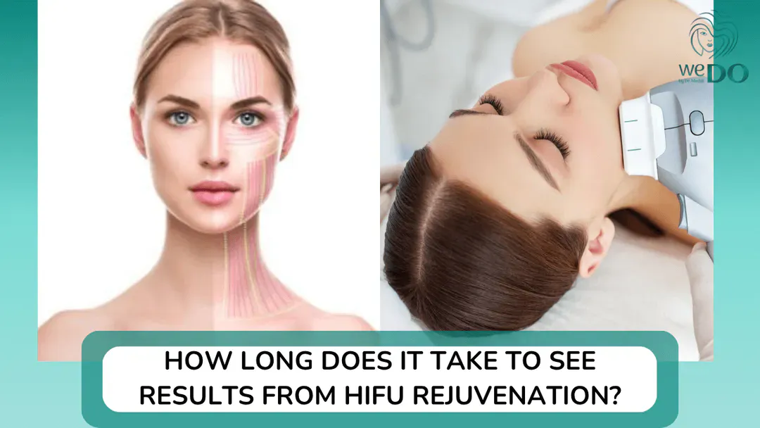 How long does it take for Hifu to show results?