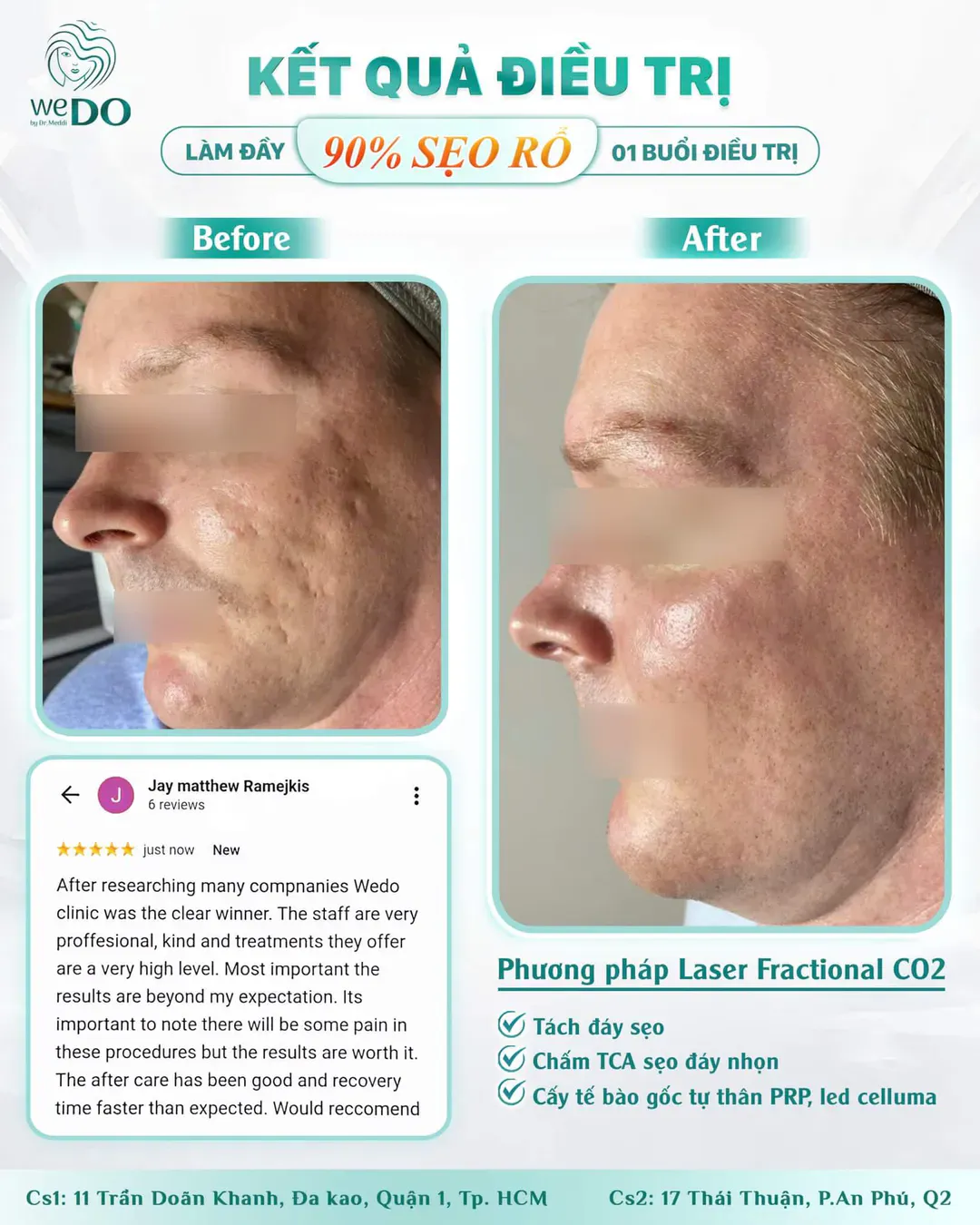 Cùng Jay - Goodbye Scars, Hello Confidence!