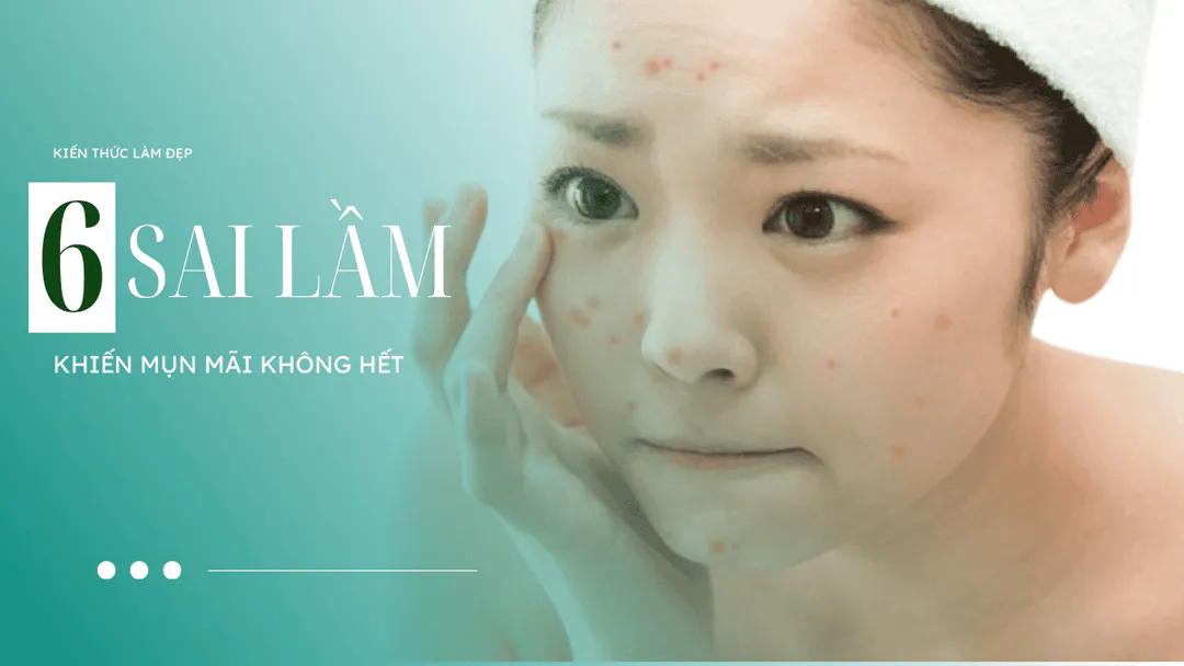 Vạch trần những sai lầm khiến mụn mãi không hết
