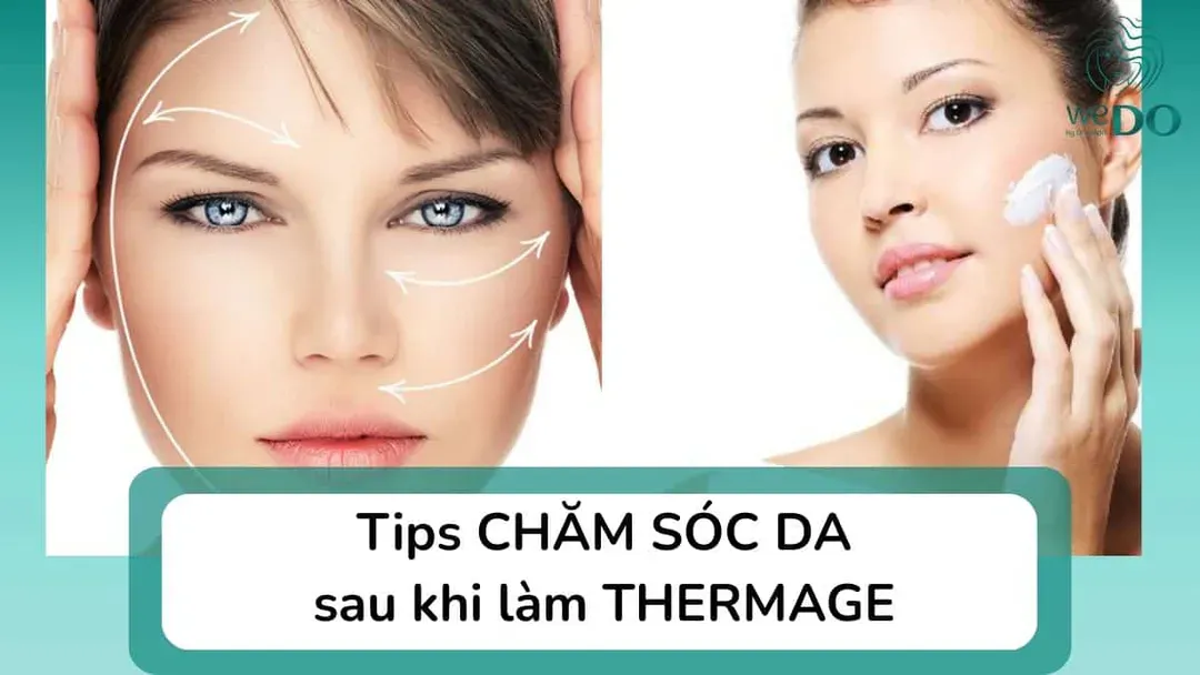Tips chăm sóc da sau khi làm Thermage để giữ kết quả tối ưu