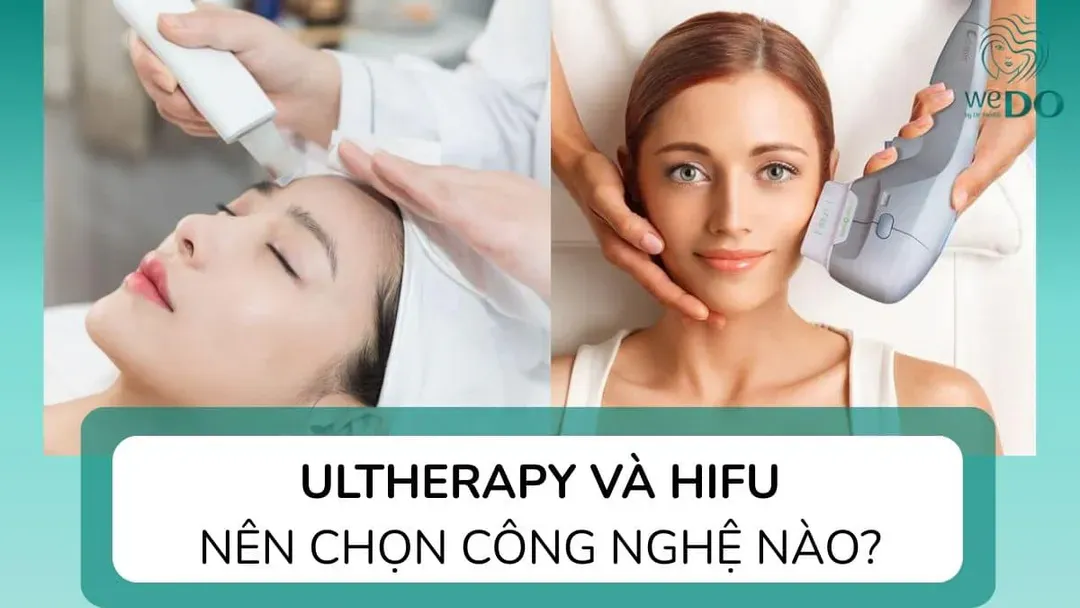 So sánh công nghệ nâng cơ Ultherapy và Hifu: Đâu là lựa chọn tốt nhất?
