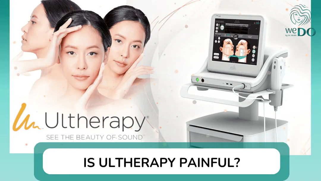 Does Ultherapy hurt? 7 important things to know before doing it