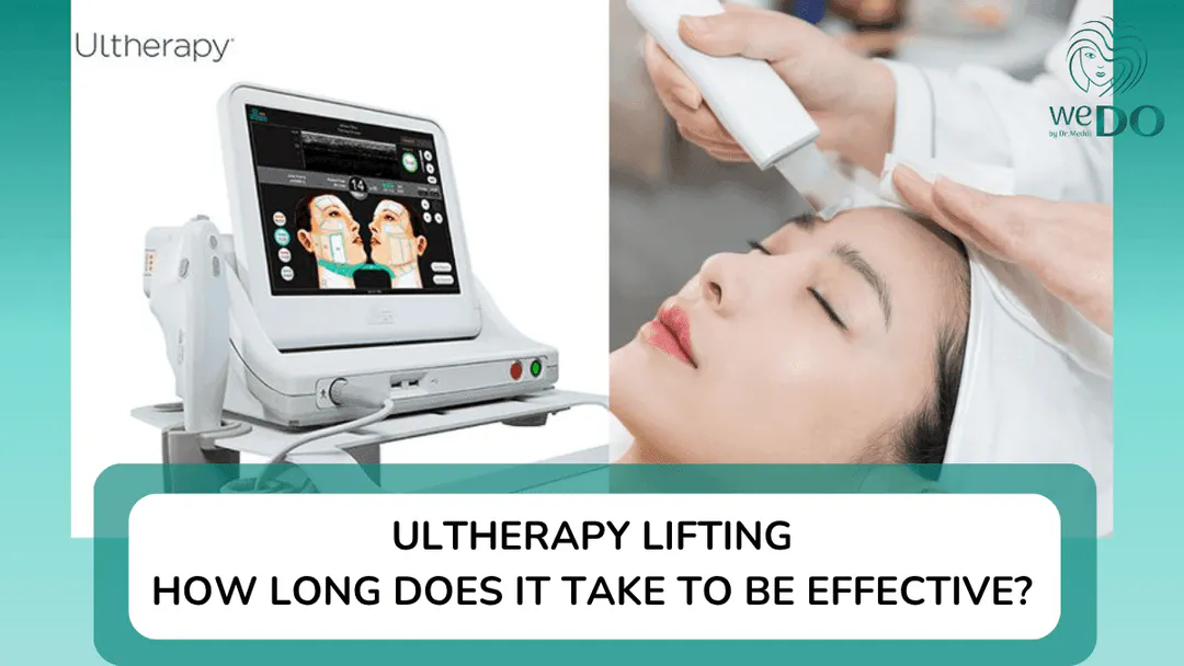 How long does it take for Ultherapy to work? How long do the results last?
