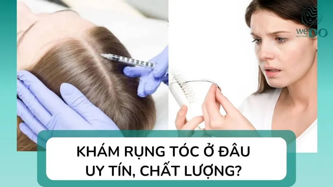 Khám rụng tóc ở đâu tại TP.HCM? Top 5 địa chỉ khám và điều trị rụng tóc hiệu quả
