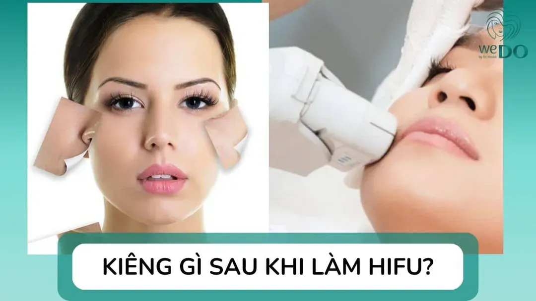 Kiêng gì sau khi làm Hifu? Hướng dẫn chăm sóc da chuẩn khoa học