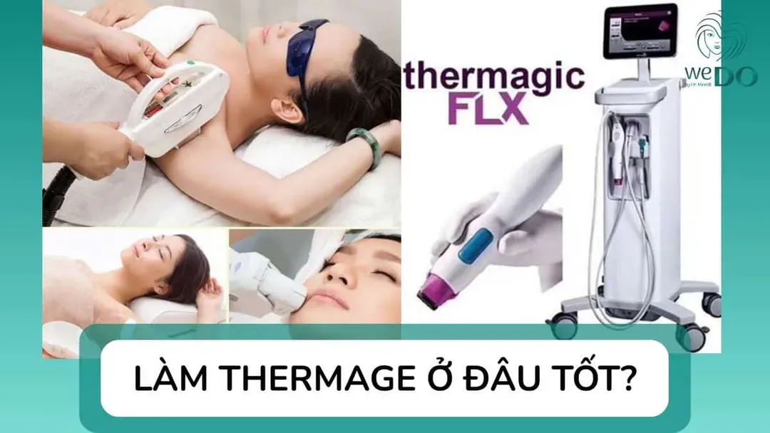Làm Thermage ở đâu tốt? 3 địa chỉ trẻ hóa da bằng Thermage tại TP.HCM