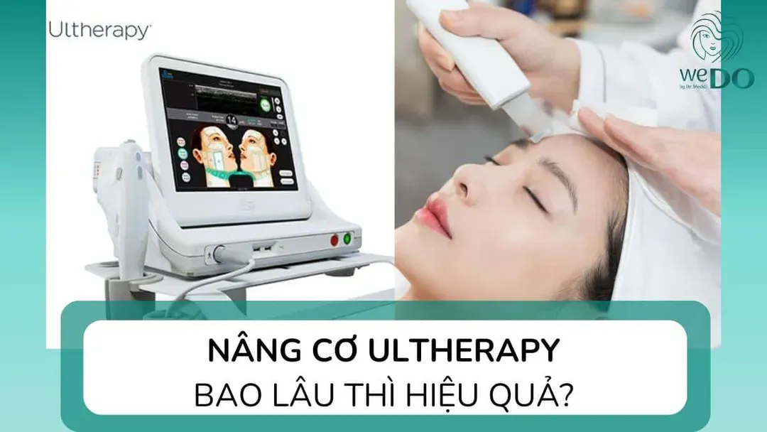 Ultherapy bao lâu có hiệu quả? Kết quả duy trì được trong bao lâu?