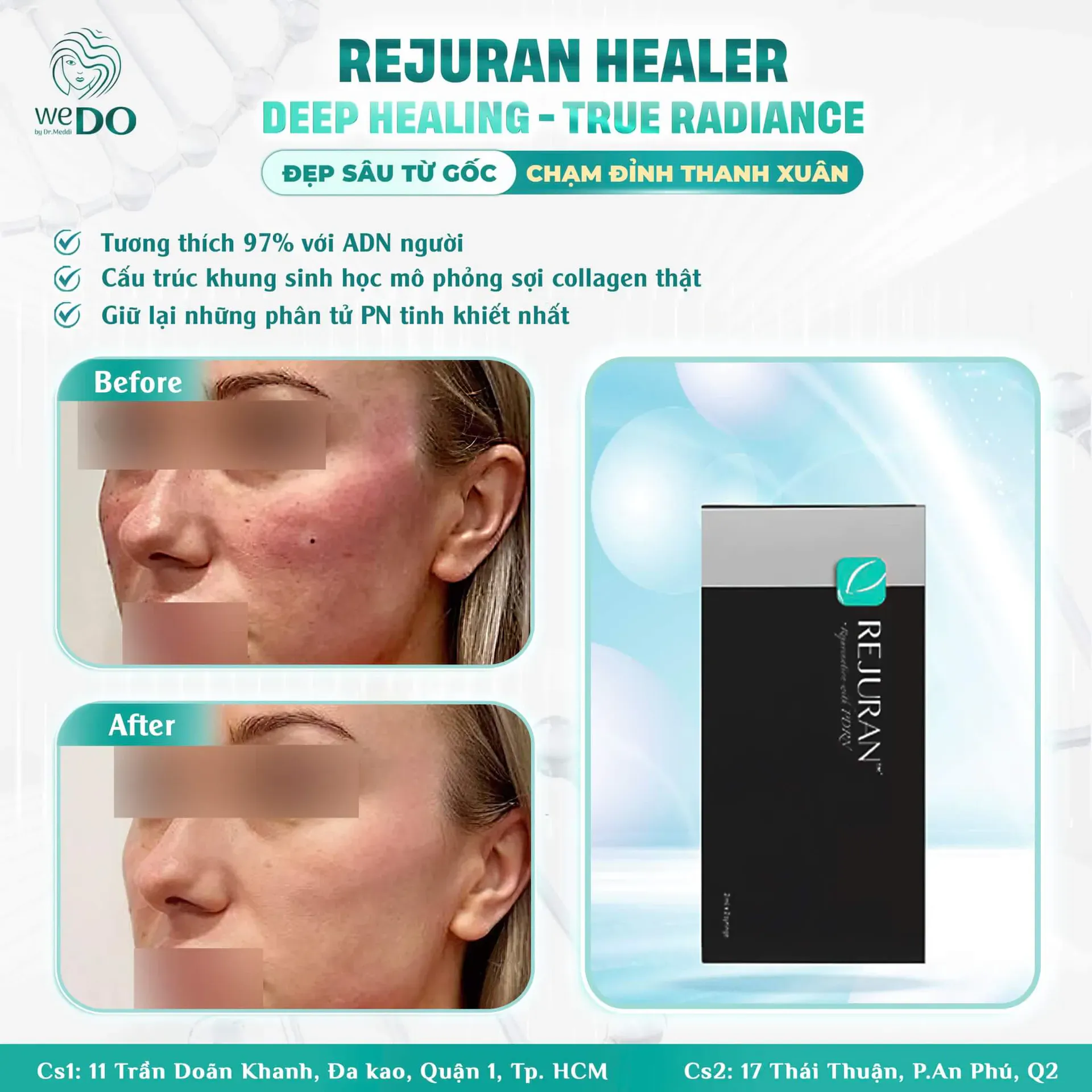 Rejuran Healer – where your skin gets real, long-term rejuvenation from within