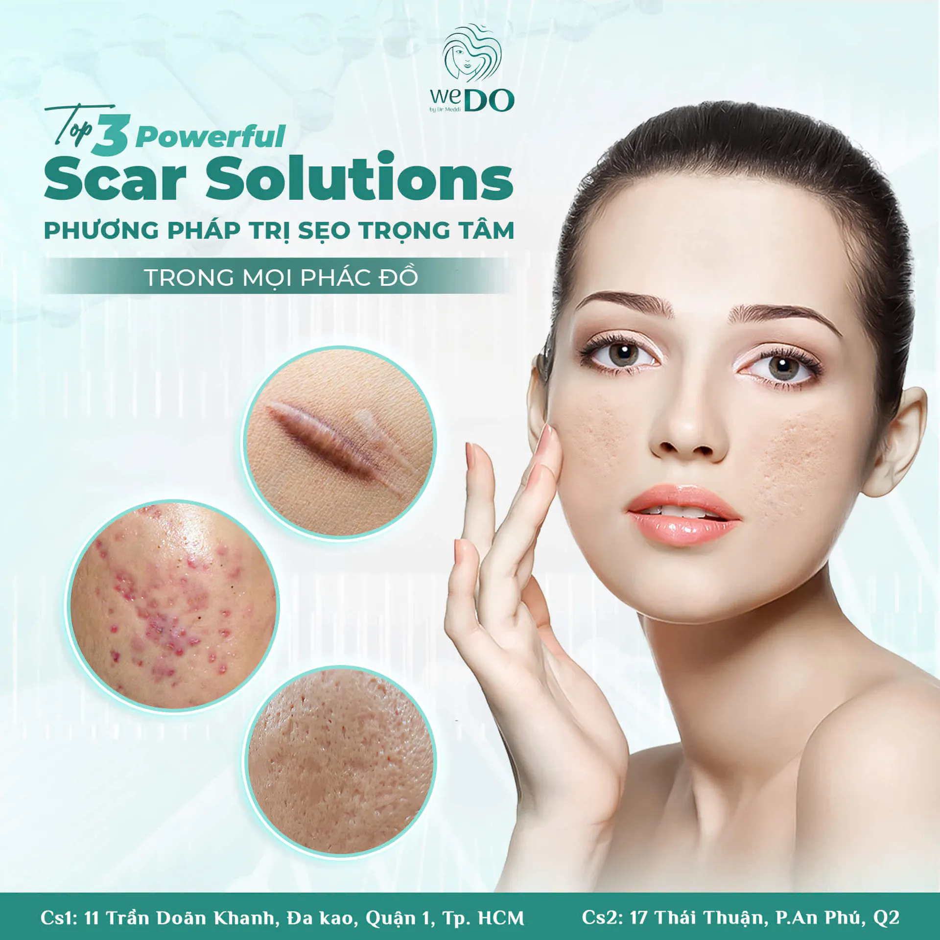 TOP 3 POWERFUL SCAR SOLUTIONS