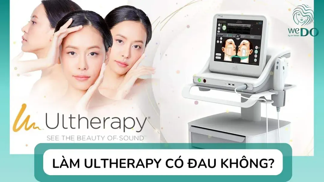 Làm Ultherapy có đau không? 7 điều quan trọng cần biết trước khi thực hiện