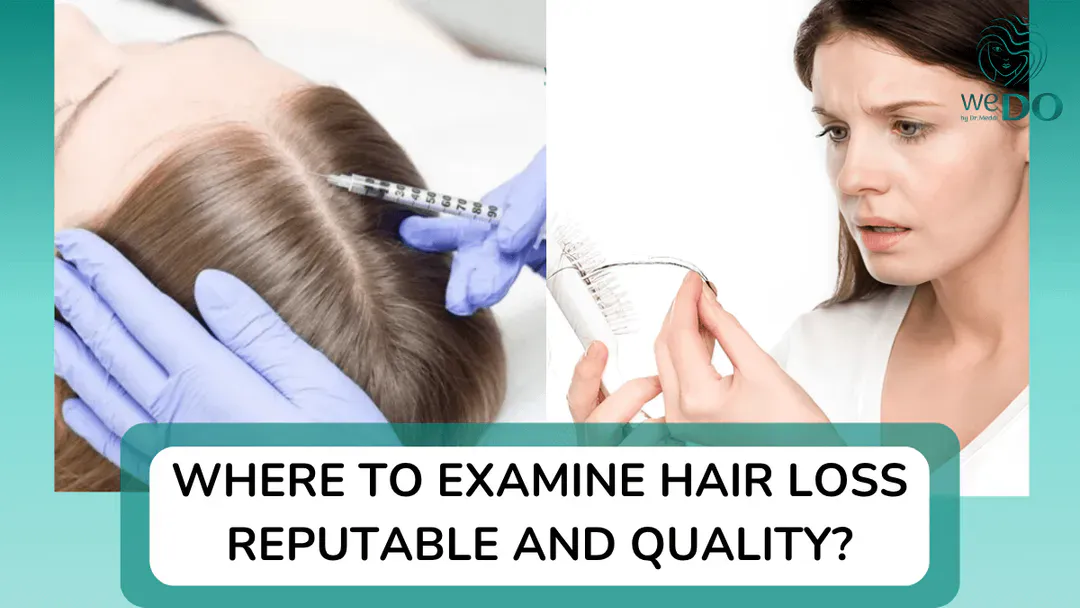 Where to examine hair loss in Ho Chi Minh City?
