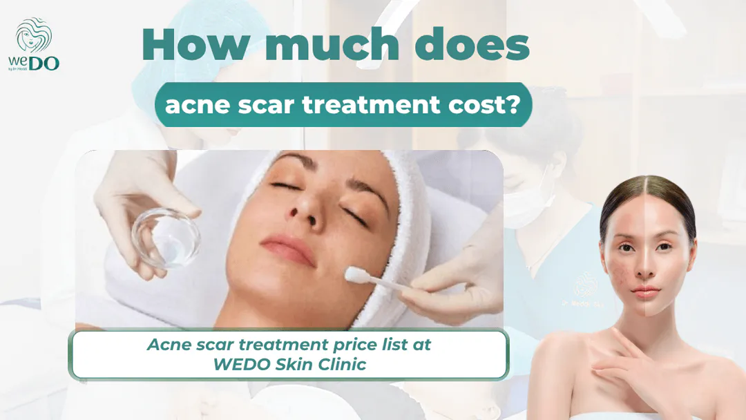 How Much Does Acne Dark Spot Treatment Cost? Acne Dark Spot Treatment Price List at WeDo Skin Clinic