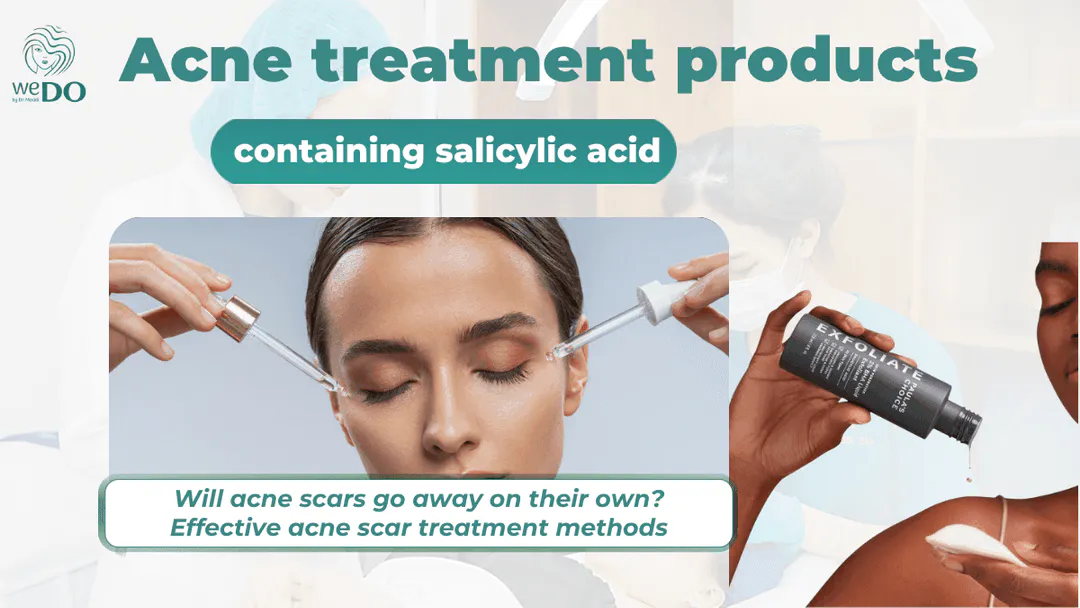 Top 5 acne treatment products containing salicylic acid that are safe for acne-prone skin