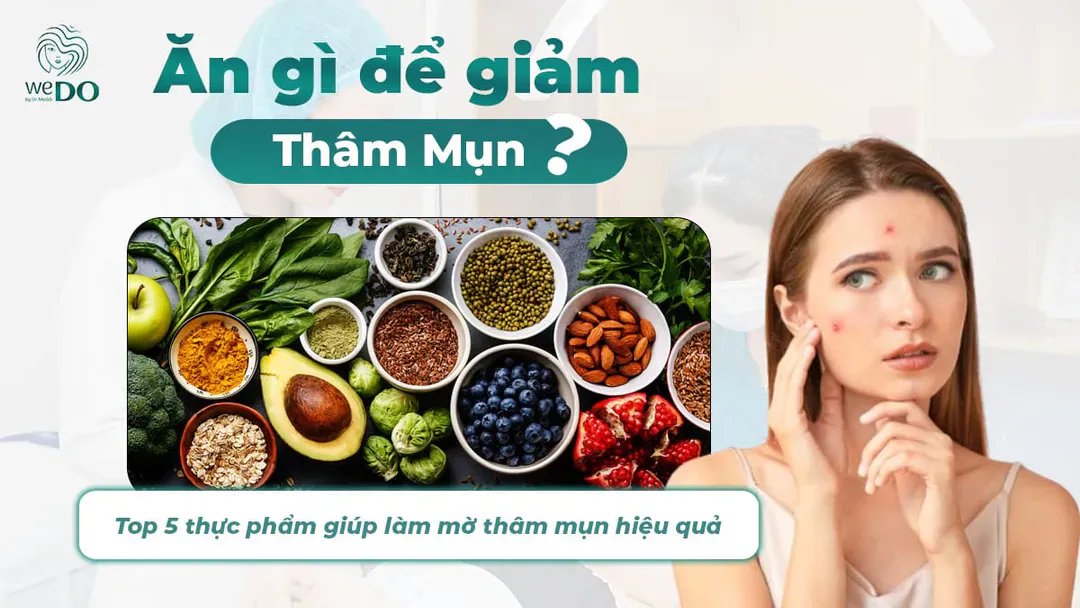 Ăn gì để giảm thâm mụn? Top 5 thực phẩm giúp làm mờ thâm mụn hiệu quả