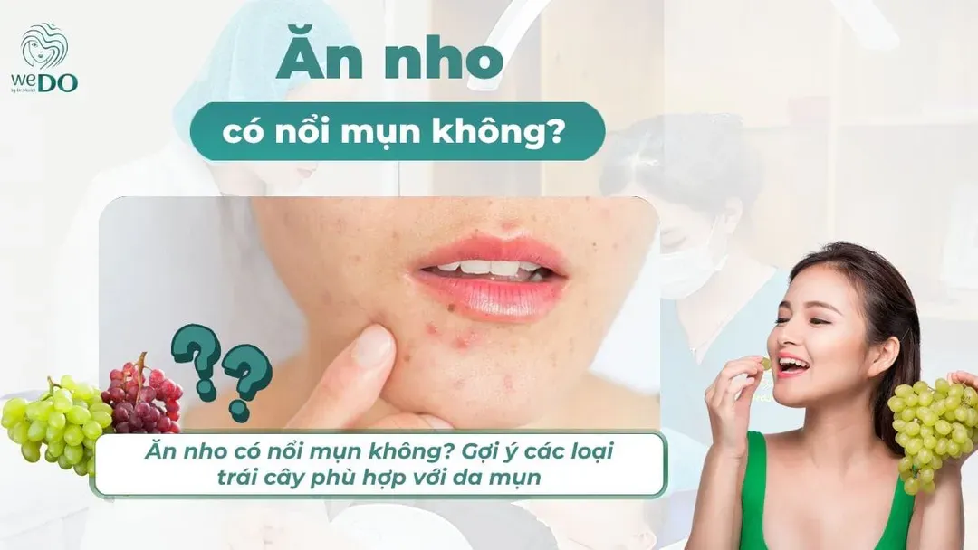 Ăn nho có nổi mụn không? Gợi ý các loại trái cây phù hợp với da mụn