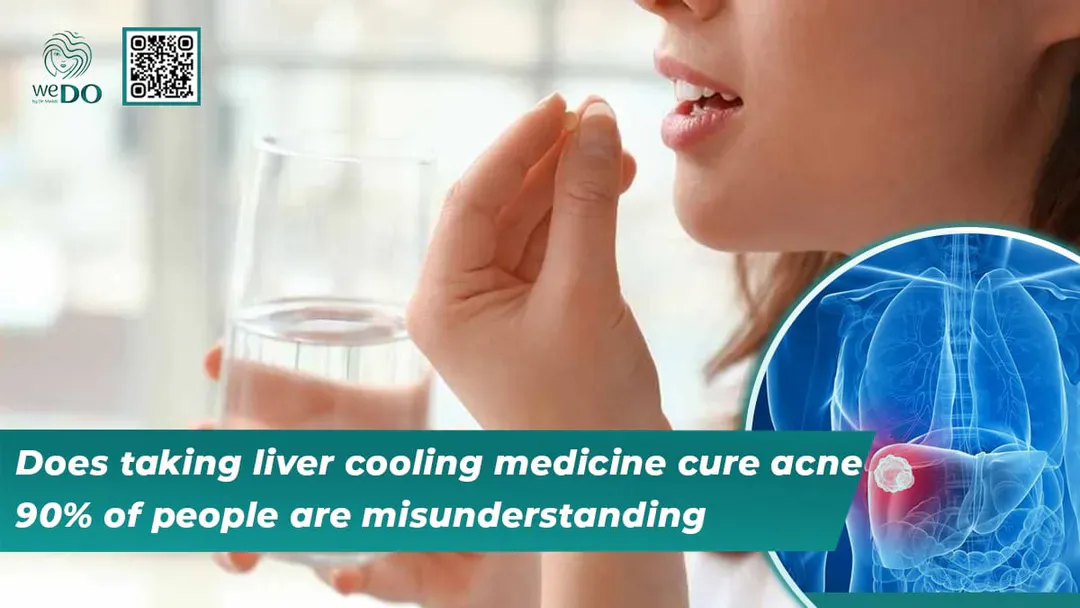 Does taking liver cooling medicine cure acne? 90% of people are misunderstanding