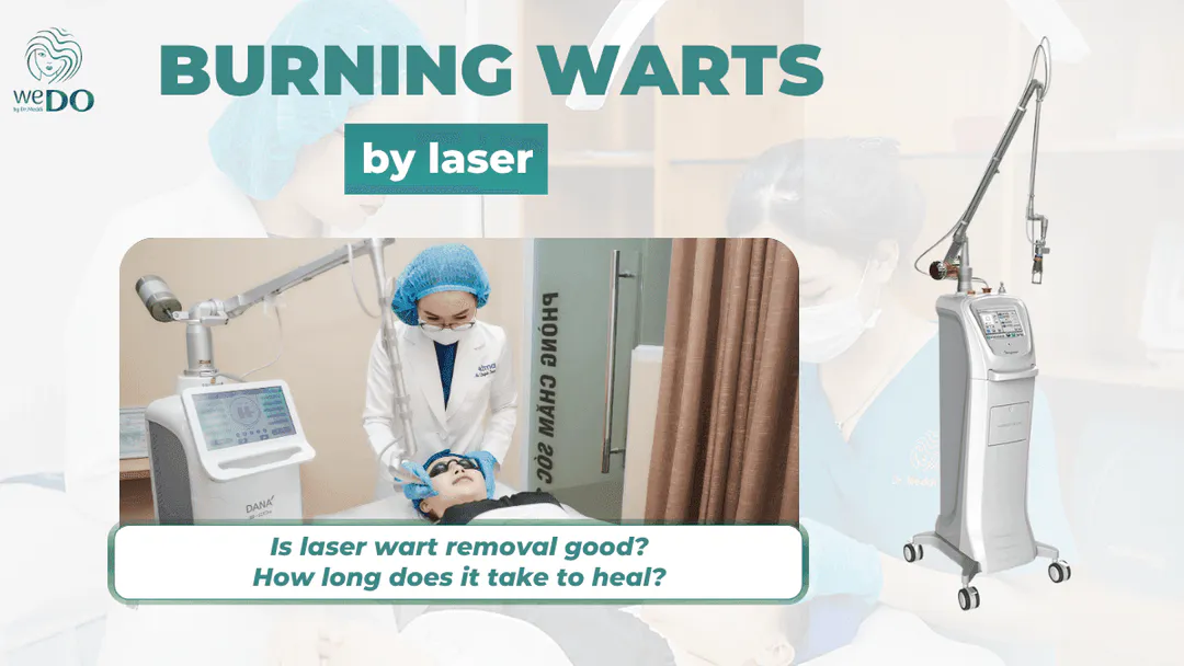 Is laser wart removal good? How long does it take to heal?