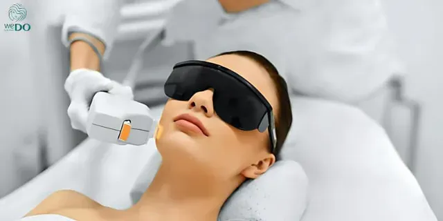 Công nghệ IPL giúp loại bỏ các hắc sắc tố bằng ánh sáng quang học