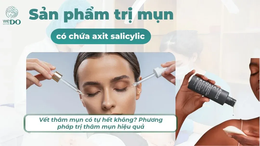 Top 5 sản phẩm trị mụn có chứa axit salicylic an toàn cho da mụn