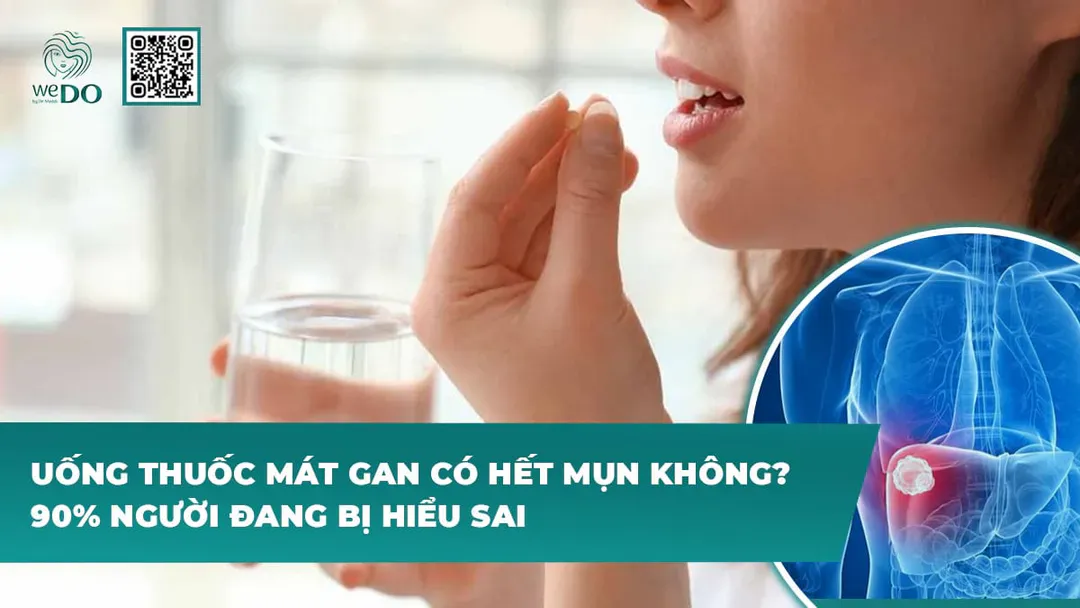 Uống thuốc mát gan có hết mụn không? 90% người đang hiểu sai