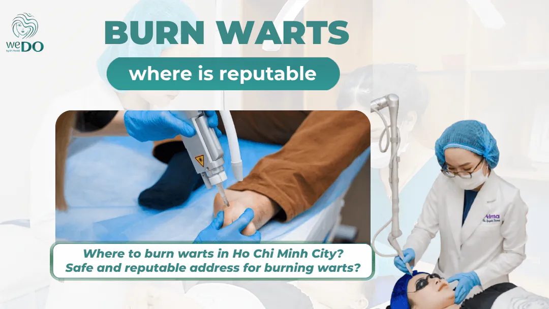 Where to burn warts in Ho Chi Minh City? Safe and reputable address for burning warts