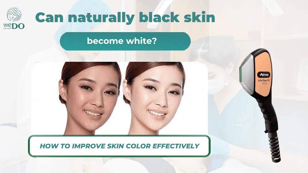 Can naturally black skin become white? How to effectively improve skin color
