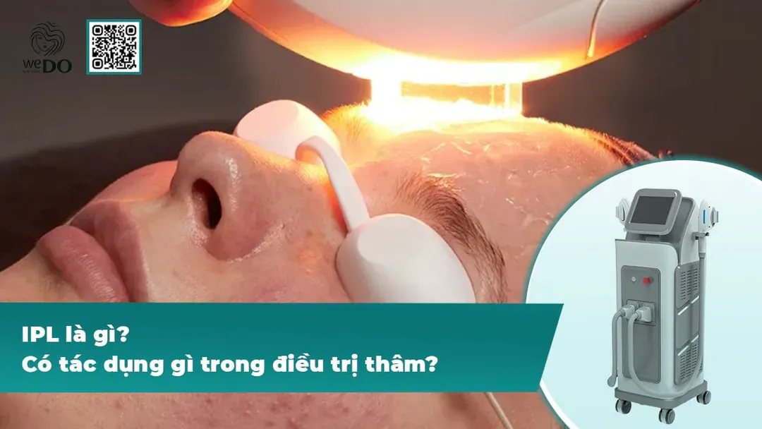 Ánh sáng IPL giảm viêm đỏ, mờ thâm sau mụn