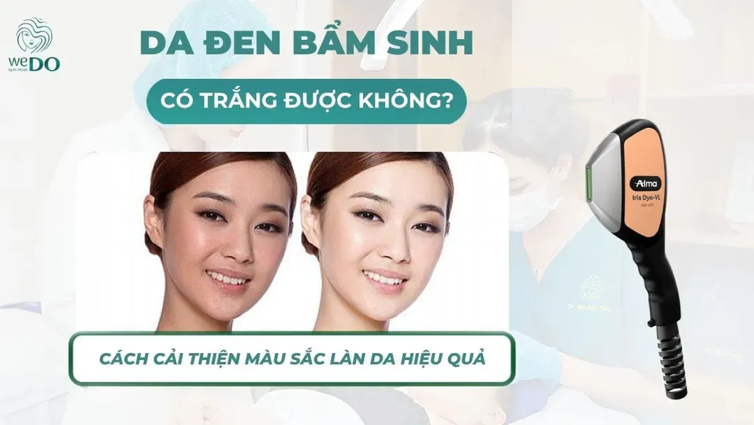 Da đen bẩm sinh có trắng được không? Cách cải thiện màu sắc làn da hiệu quả